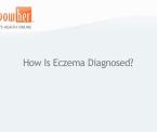 how to diagnose eczema