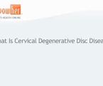 understanding cervical degenerative disc disease