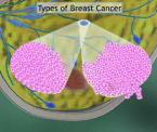 learn about breast cancer