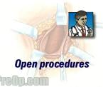 general open surgery